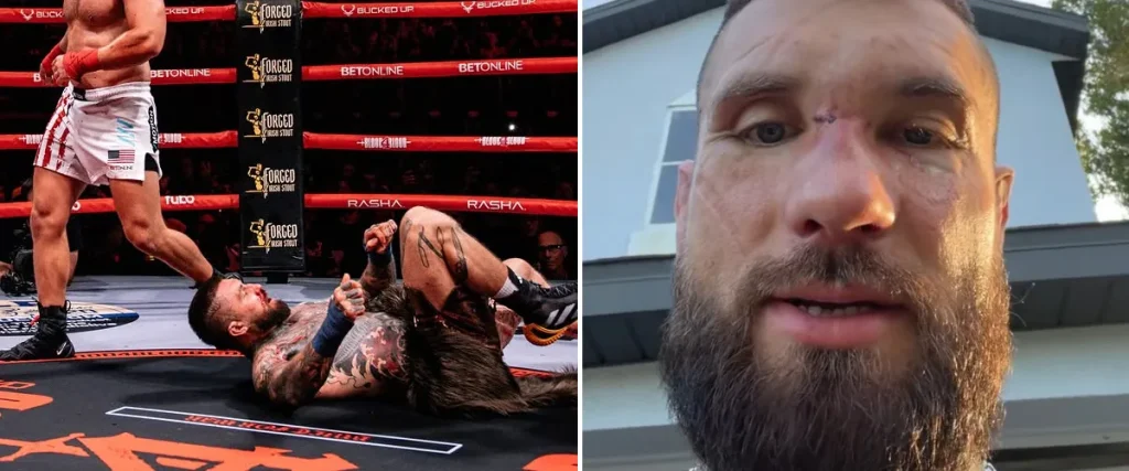 The Mosh Network - Alex Terrible after his Blood4Blood fight 2026